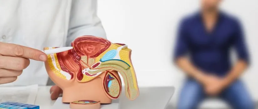 Uro Oncology Treatment