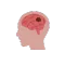 Brain Tumors