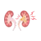 Kidney Stones